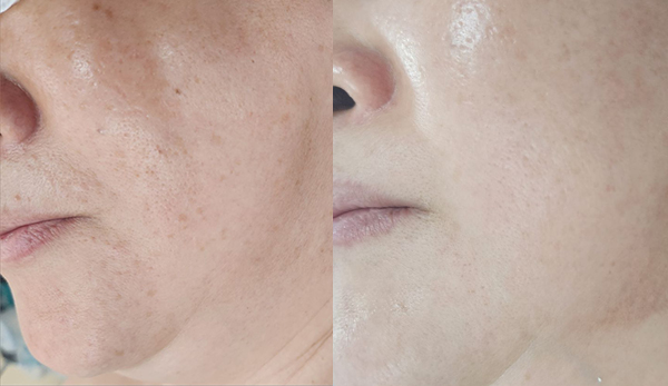 la skincare | 엘에이 스킨케어 | ksy skincare