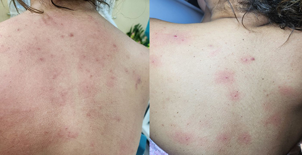la skincare | 엘에이 스킨케어 | ksy skincare